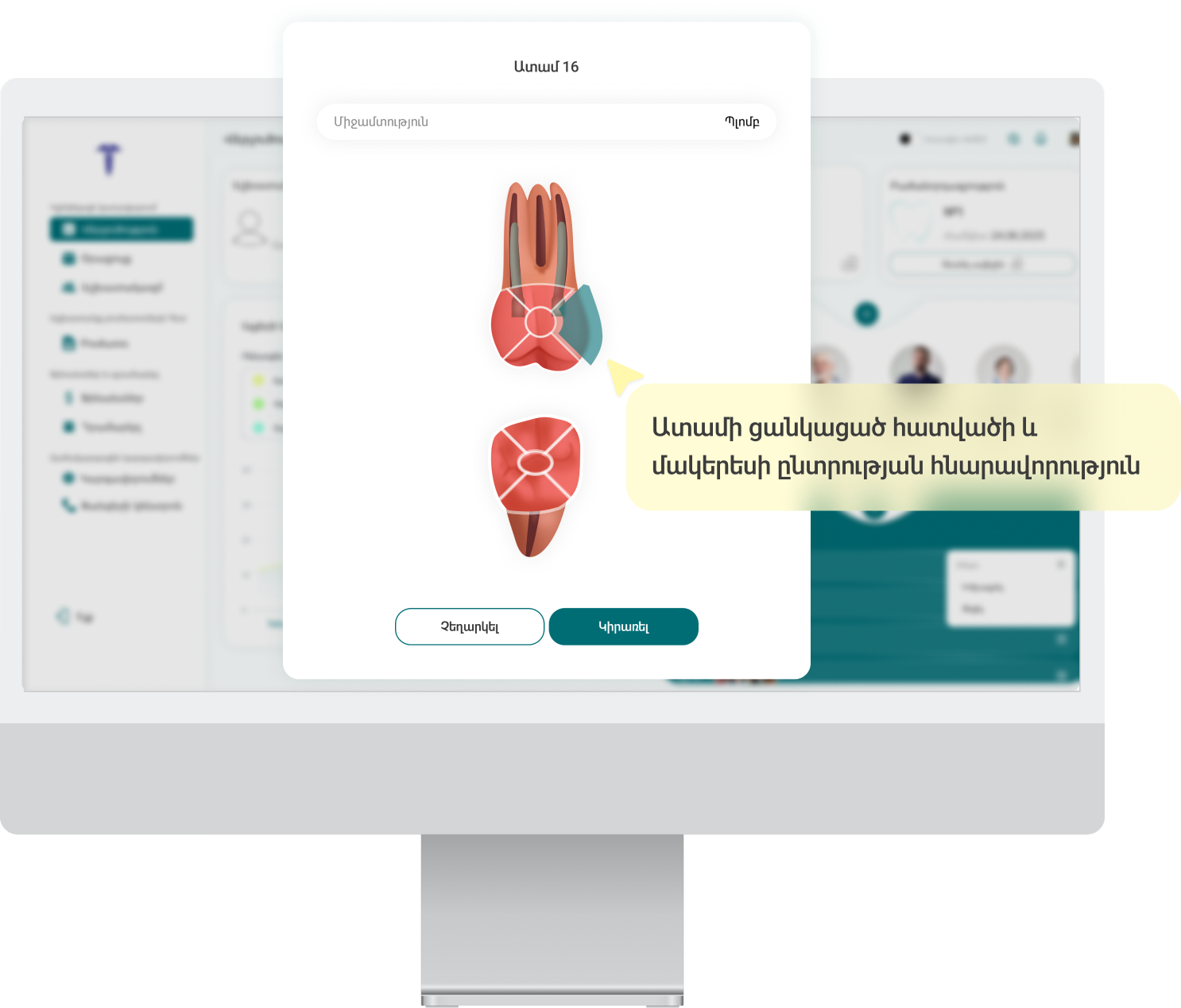 teeth map mock image